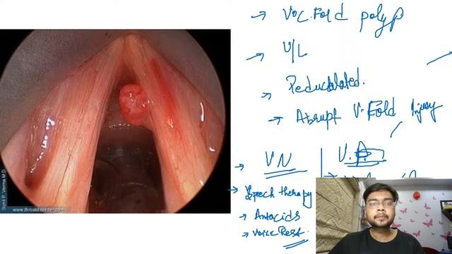 Neet Pg (Recent NBE type Image MCQs) with Dr.Shivaam Kesarwaani. смотреть онлайн