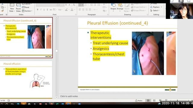 Nursing I Respiratory diseases and meds смотреть онлайн