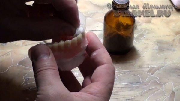 ЗУБНЫЕ ПРОТЕЗЫ. Починка съёмного зубного протеза.