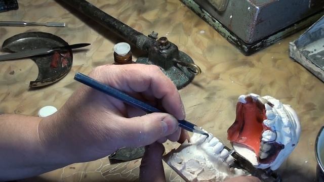 ЗУБНЫЕ ПРОТЕЗЫ. Изготовление съёмных зубных протезов - 1 - постановка зубов на съёмный протез смотреть онлайн