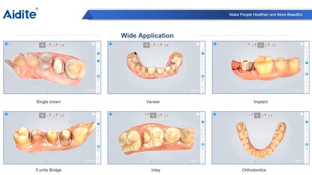 20201215 Vanik intraoral scanner-Spanish смотреть онлайн