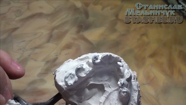 Прикусные шаблоны для последующей обточки и моделировки зубов при сложных или заниженных прикусах смотреть онлайн