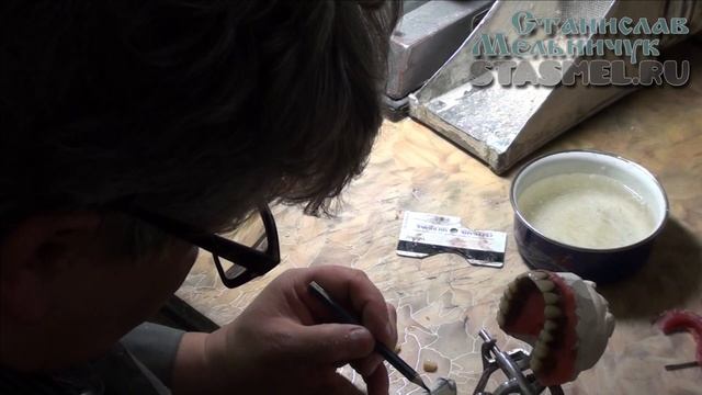 ЗУБНЫЕ ПРОТЕЗЫ. Съёмный зубной протез, постановка зубов "по стеклу". смотреть онлайн