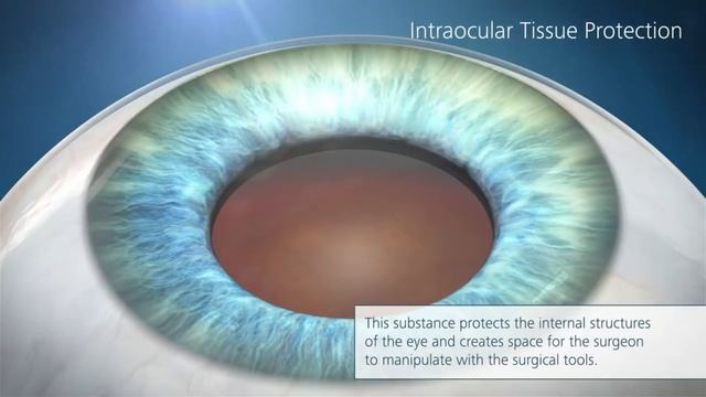 Human Eye Complete Structure | Human Eye Structure Model | Human Eye Anatomy 3d Model смотреть онлайн