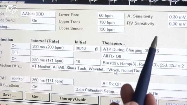 ICD Interrogation - Medtronic