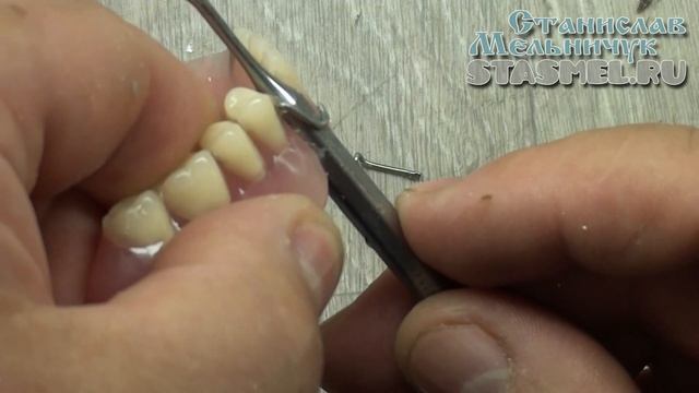 СТОМАТОЛОГИЯ. Как правильно подгибать кламмеры. Как сделать крючки у протеза потуже. смотреть онлайн