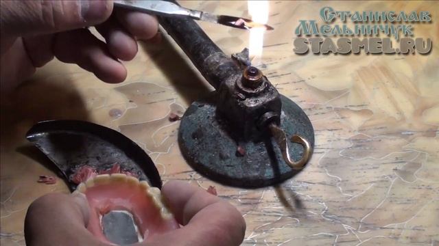 ЗУБНЫЕ ПРОТЕЗЫ. Перебазировка верхнего съёмного зубного протеза с добавлением клапана. смотреть онлайн