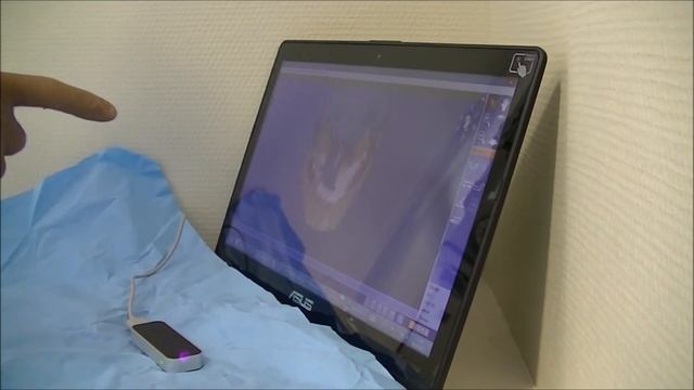 Leap motion au bloc operatoire смотреть онлайн