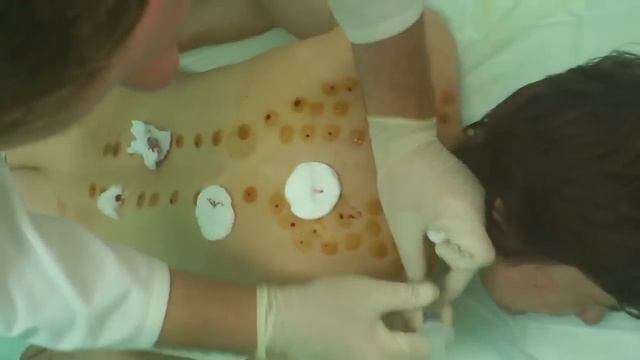 189. Выполнение процедуры.РОССИЙСКИЙ метод RANC. Краснодар. смотреть онлайн