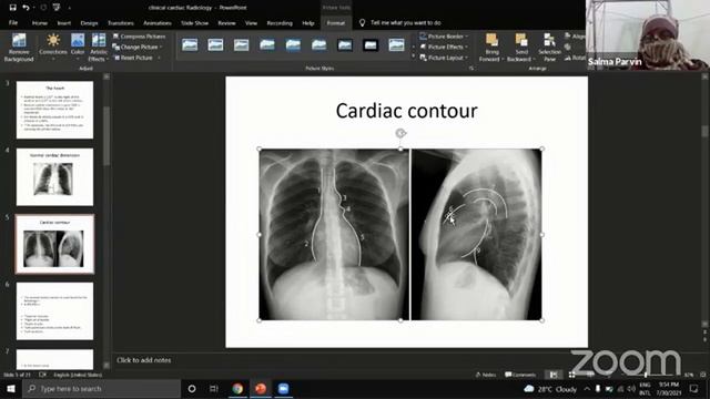 Cardiac radiology (class-1) смотреть онлайн