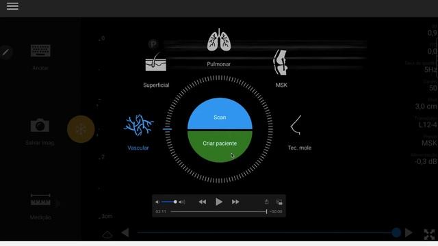 Tutorial de Manuseio do Equipamento Philips Lumify смотреть онлайн