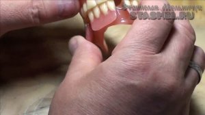 ЗУБНЫЕ ПРОТЕЗЫ. Расположение зубов на съёмных протезах при перекрёстном прикусе.