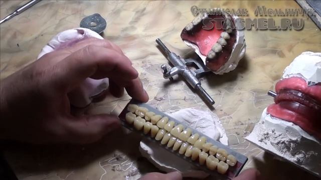 ЗУБНЫЕ ПРОТЕЗЫ. Подготовка к варке съёмного зубного протеза. Удаление лишнего воска смотреть онлайн