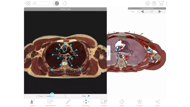 [PROMO] Human Anatomy Atlas 2018 for Android | Visible Body смотреть онлайн