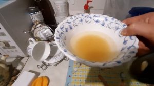 100% лечение коксартроза тазабедренного сусава МОГУЩЕСТВО КОЛАГЕНА!