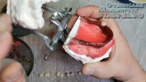 Верхний ЗУБНОЙ ПРОТЕЗ. Постановка зубов в жутком обратном прикусе. Мои рассуждения и действия. ч.2.