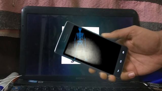 Working X-RAY APP for Android !! **Turn on CC** смотреть онлайн