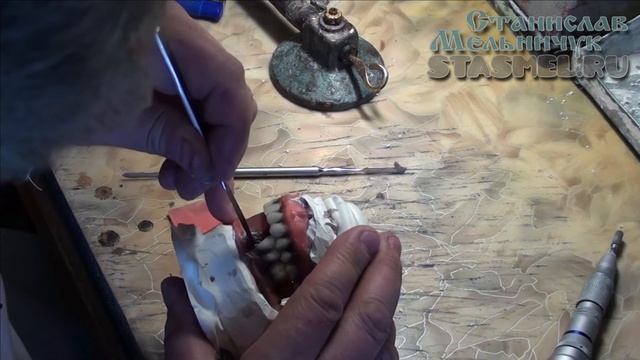 ЗУБНЫЕ ПРОТЕЗЫ. Полные съёмные зубные протезы. Постановка зубов по стеклу. Часть 2. смотреть онлайн