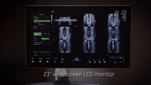 GE Voluson S6 S8 смотреть онлайн