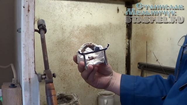 Подготовка постановки будущего съёмного зубного протеза к загипсовке и гипсовка в кювету смотреть онлайн