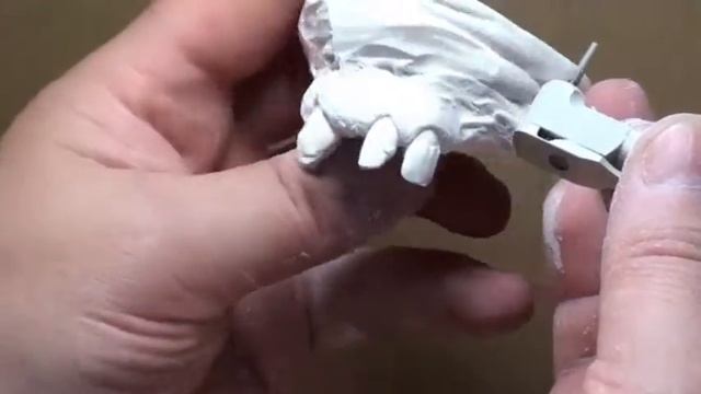 Использование гипсовой модели в качестве челюсти пациента смотреть онлайн