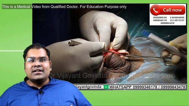 लिंग की चमड़ी बंद है | Total Phimosis "Original ZSR" Circumcision (Hindi) смотреть онлайн