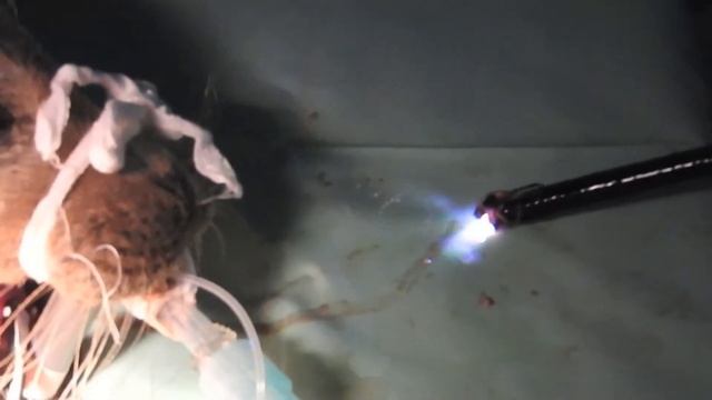 Removal of fish hooks by endoscopy смотреть онлайн