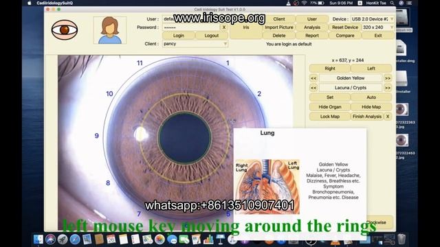 iridology camera for mac iriscope for mac iriscope compatible mac смотреть онлайн
