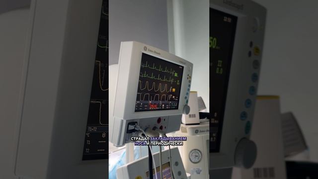 👃 Вазотомия в Медцентре доктора Александровского. Оперирует отоларинголог Рагим Садыхов смотреть онлайн