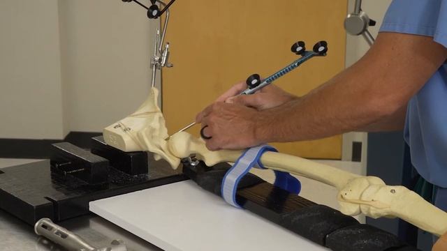 Total Hip Replacement Utilizing Mako Robot with Dr. Mark Cutright смотреть онлайн