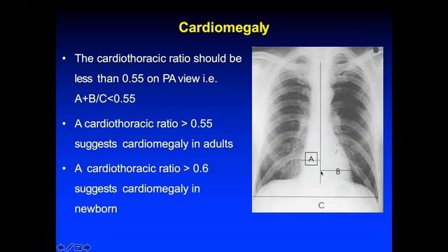 Chest X-ray Basics смотреть онлайн