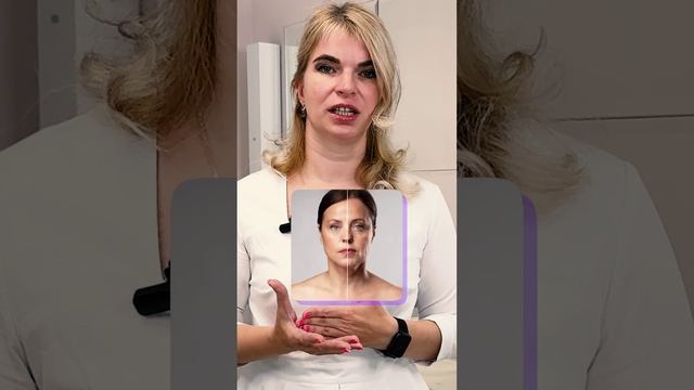 Что такое углы молодости