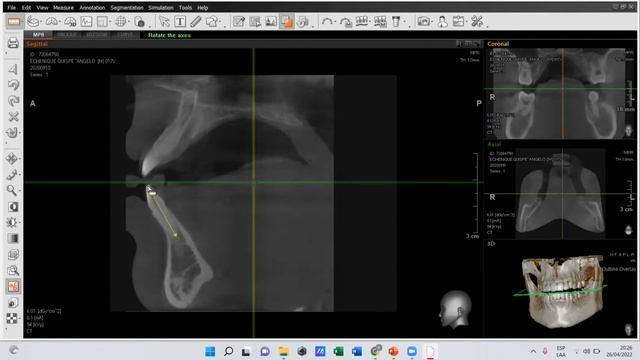 Utilización y lectura de tomografía computarizada-Simple Viewer Launcher смотреть онлайн