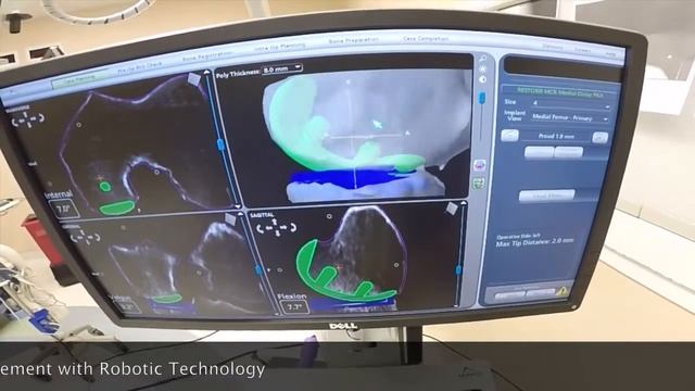 Dr. Peterson Mako Surgery смотреть онлайн