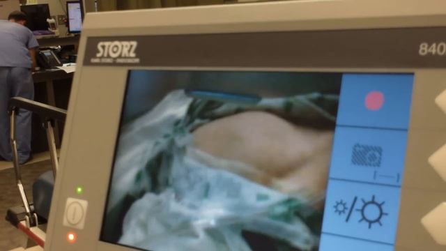 Using The Bougie For Endotracheal Intubation