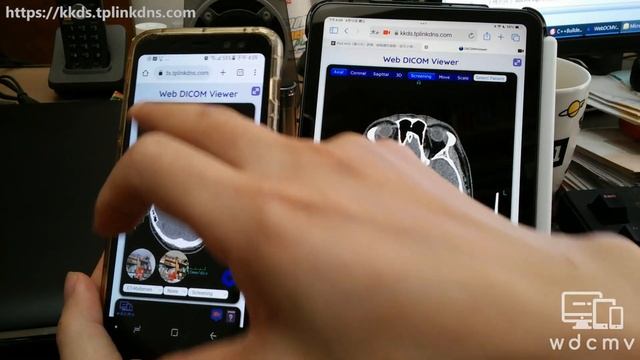 Use Web DICOM Viewer for teleconsultation through WebRTC (original version) смотреть онлайн