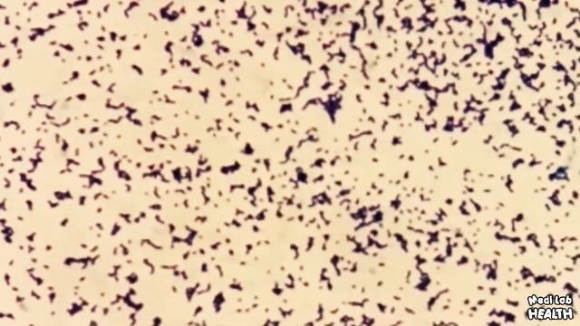 Staphylococcus aureus gram stain microscopic observation смотреть онлайн