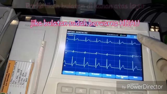 Tutorial Elektrokardiografi (EKG) GE MAC 800 смотреть онлайн