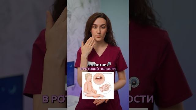 🧫 Энтеровирусная инфекция смотреть онлайн