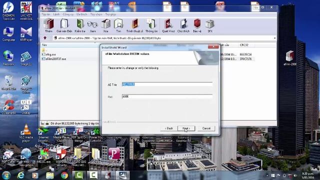 PHAN MEM DOC PHIM XQ, CT, MRI TREN WINDOWS (XP,VISTA,7,8,10) смотреть онлайн