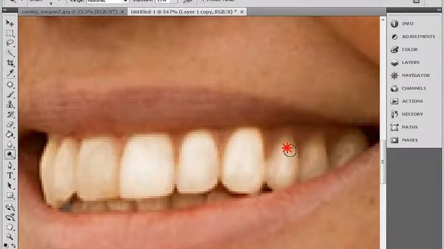 Dodge Tool ile Diş beyazlatma смотреть онлайн