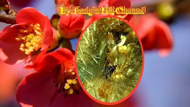 biggest ear wax removal || Cleaning ear смотреть онлайн