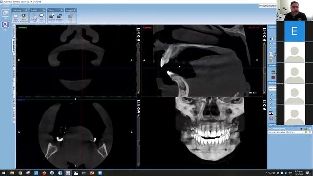 3-2-CURSO DE ROMEXIS VIEWER (2da. Parte) смотреть онлайн