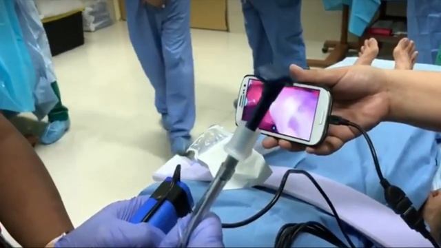 3D printed video laryngoscope intubation. AirAngel blade + Android Smartphone. смотреть онлайн