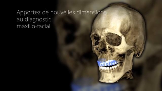 Planmeca Romexis® - Les nouvelles charactéristiques смотреть онлайн