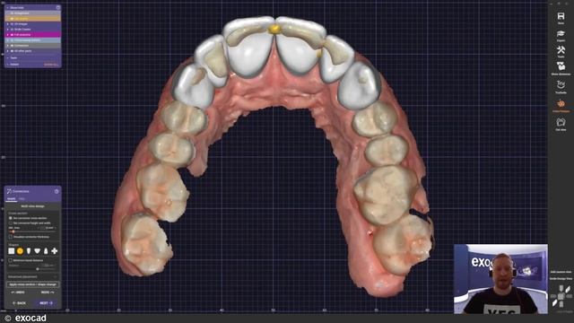 DentalCAD 3.0 Galway SMILE CREATOR (EN) смотреть онлайн