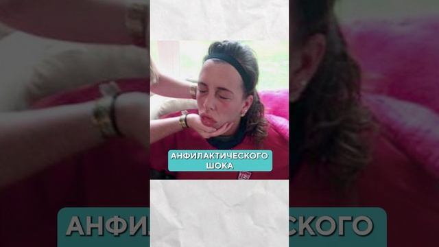 Чем ОПАСНО удаление филлера? #кожа #процедуры #косметология смотреть онлайн