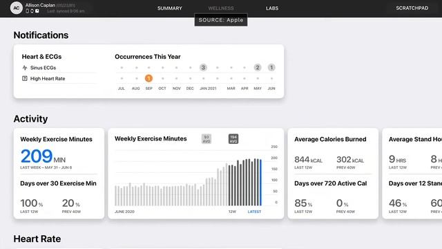 watchOS 8 超強健康功能｜快幫長輩買一台吧 смотреть онлайн