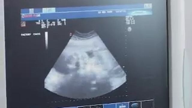 Уже два года Алексинский родильный дом функционирует в полноценном формате смотреть онлайн