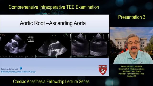 Comprehensive Intraoperative TEE Exam - Lecture 3 смотреть онлайн